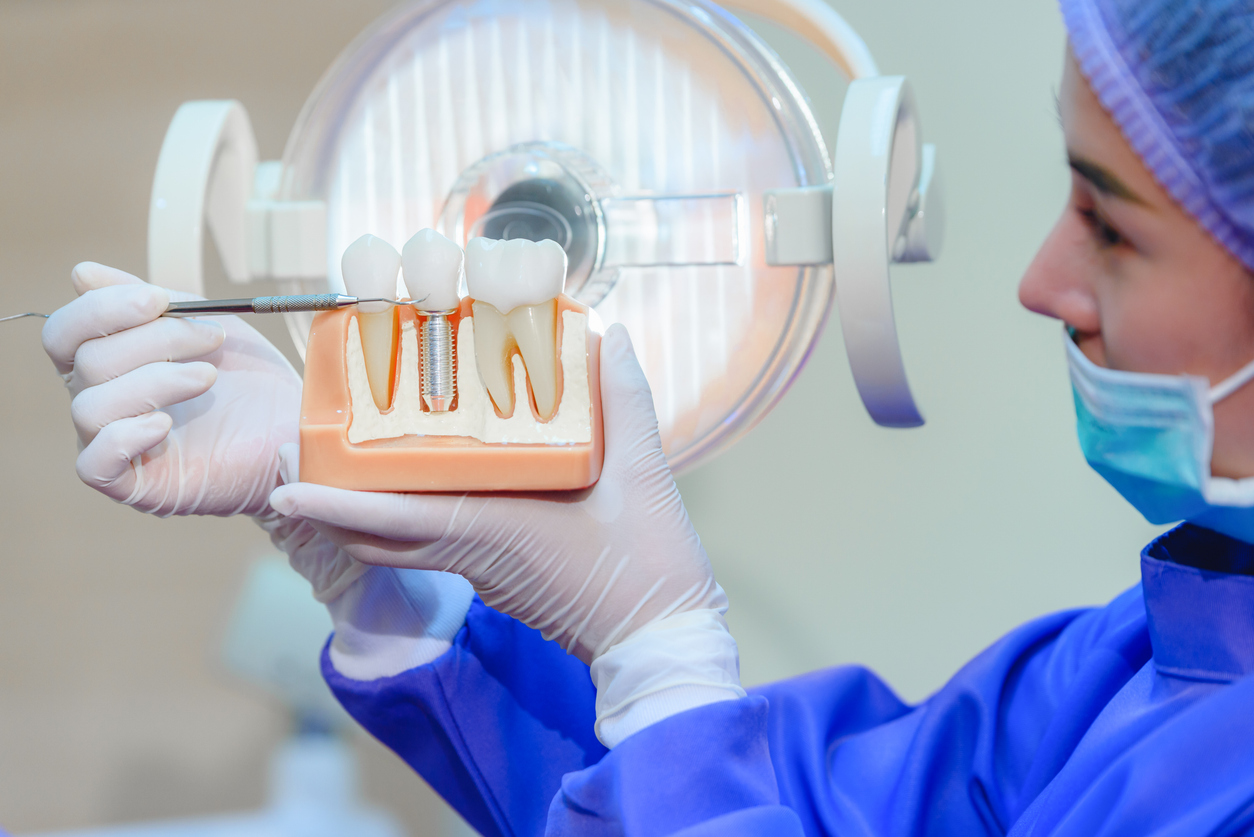 Od tokarskog stroja do svemirskih tehnologija: Kako su izumljeni i razvijani dentalni implantati?